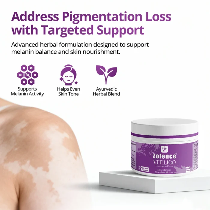 safed daag adress pigmentation