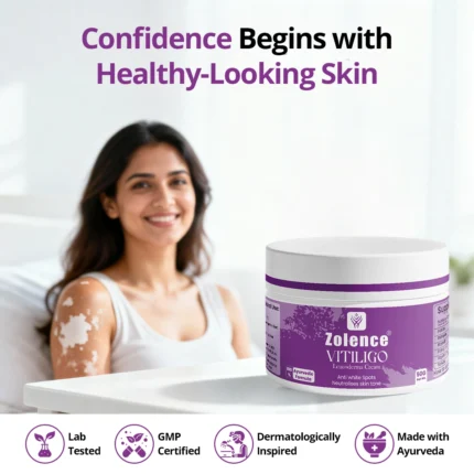 Vitiligo Cream