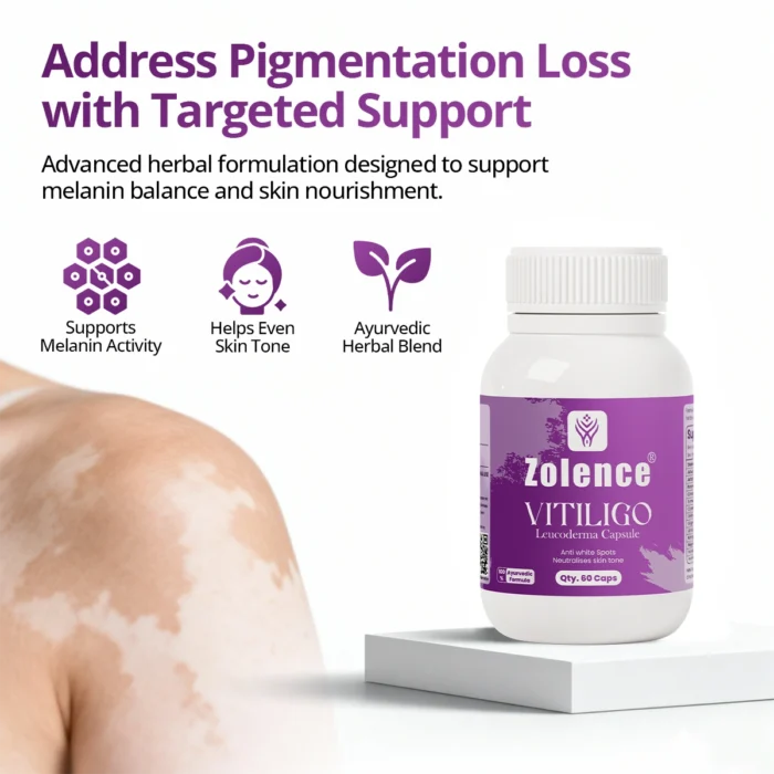 Vitiligo Capsule - Image 2