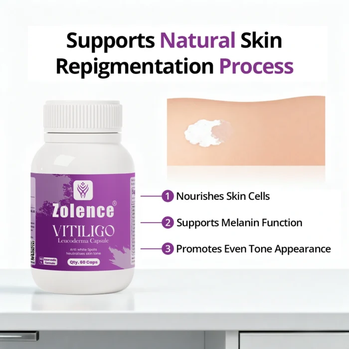 Vitiligo Capsule - Image 3