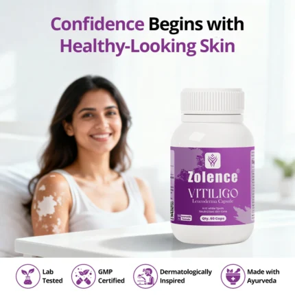 Vitiligo Capsule