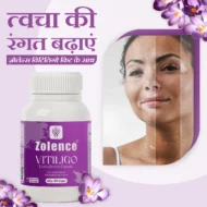 Vitiligo Capsule - Image 5