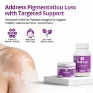 Zolence Vitiligo Care Kit - Image 2