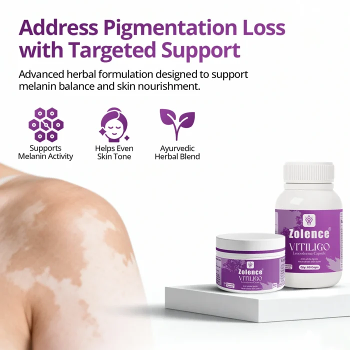 Zolence Vitiligo Care Kit - Image 2