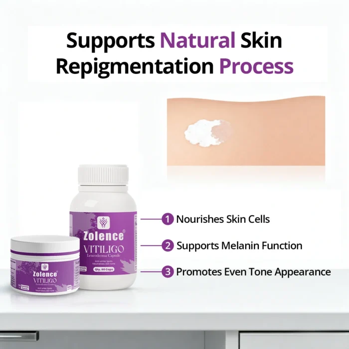 Zolence Vitiligo Care Kit - Image 3