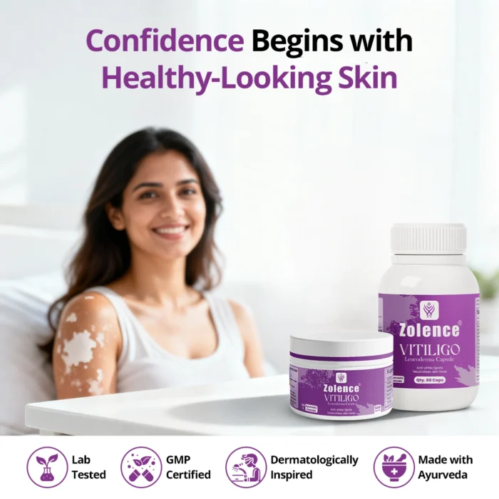 Zolence Vitiligo Care Kit - Image 4