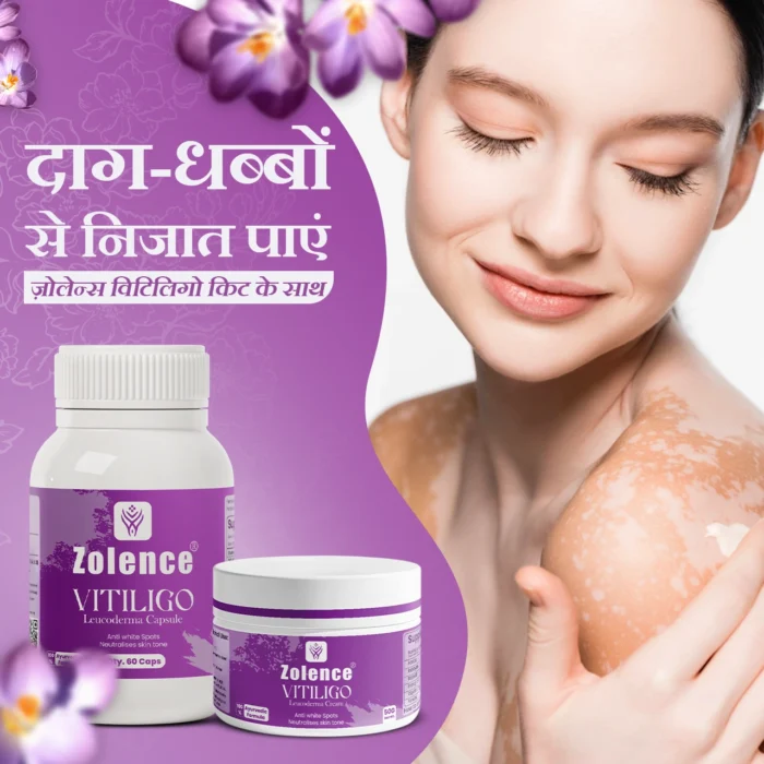 Zolence Vitiligo Care Kit - Image 5
