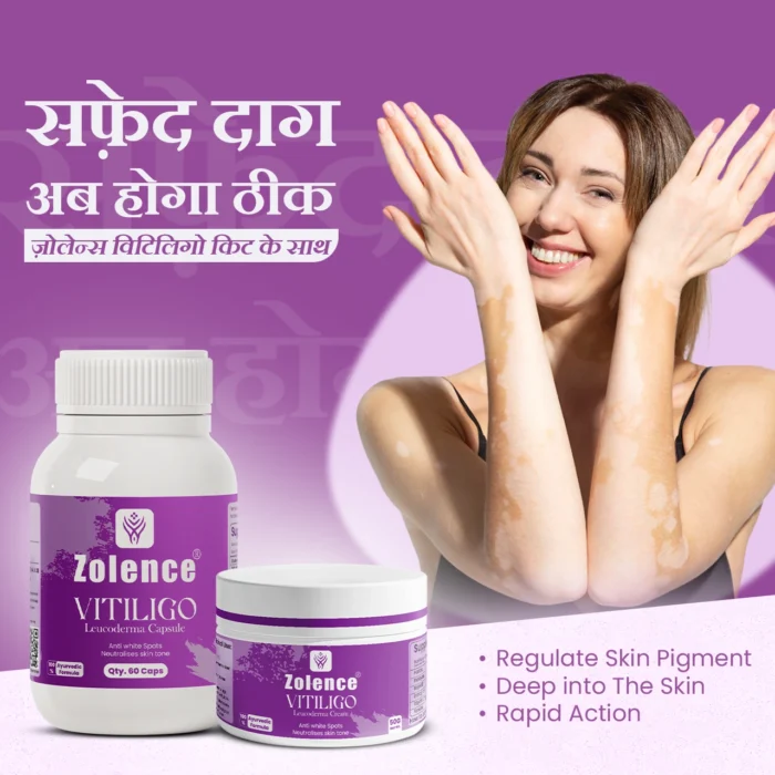 Zolence Vitiligo Care Kit - Image 6
