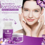 Zolence Vitiligo Care Kit