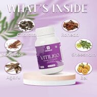 Zolence Vitiligo Care Kit - Image 4