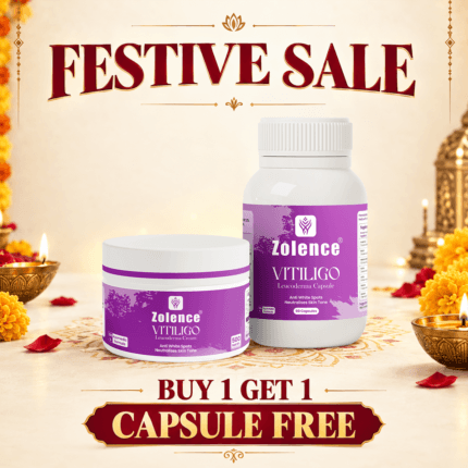 Zolence Vitiligo Care Kit